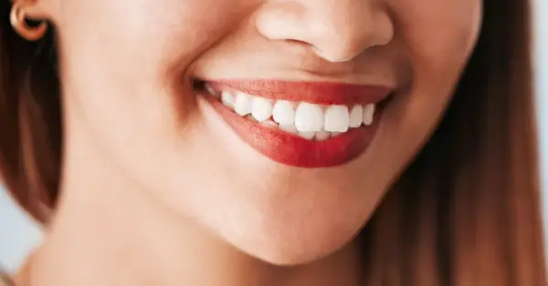 Debunking Top Myths About Teeth Whitening in Palm Desert