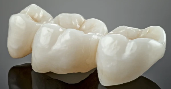 Close-up of porcelain dental crowns used for tooth restoration in dental crowns in La Quinta