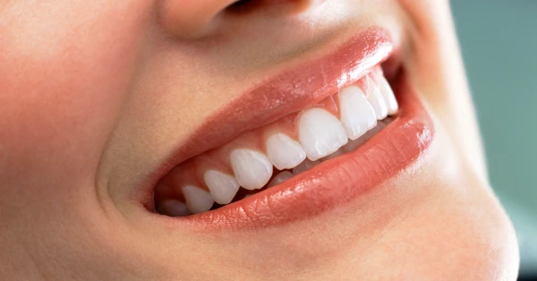 Close-up of a healthy smile demonstrating proper gum care in Palm Desert