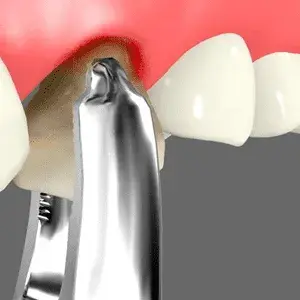 Oral Surgery Oral Surgery Rancho Mirage