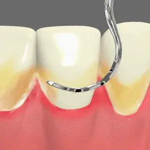 Periodontal Care Periodontal Care Rancho Mirage